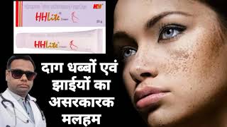 Ointment for melasma। HH lite ointment review Hydroquinone Tretinoin amp Mometasone cream। uses। [upl. by Grubman]