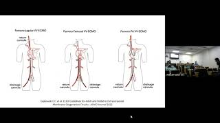 Cuidados com o paciente em ECMO [upl. by Arakihc]