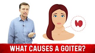 What Causes a Goiter Causes of Thyroid Enlargement – DrBerg [upl. by Docilla]