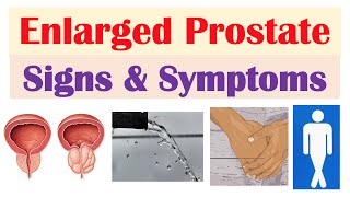 Enlarged Prostate Signs amp Symptoms amp Why They Occur [upl. by Deadman]