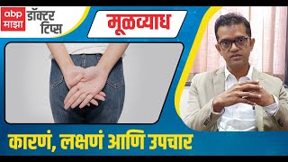 Piles  Hemorrhoids  Causes and Treatment  मूळव्याध टाळण्यासाठी काय खबरदारी घ्याल  Doctor Tips [upl. by Davina]