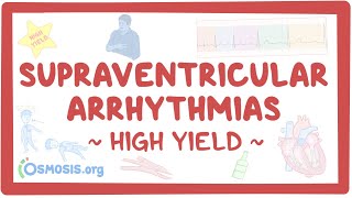 Supraventricular arrhythmias Pathology review [upl. by Hedveh]