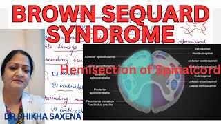 Brown Sequard Syndrome Hemisection of Spinal cord [upl. by Houser]