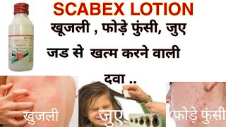 Scabex Lotion Full Information and Preview  शरीर में खुजलीफोडे फुंसीजुए मिटाने की सबसे अच्छी दवा [upl. by Bhatt]