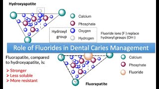 Role of Fluorides in Dental Caries Management [upl. by Hairym362]