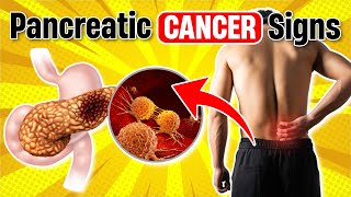 Early Warning Signs of Pancreatic Cancer You Shouldnt Ignore [upl. by Noreik]