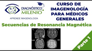 Examen del cerebro por resonancia magnética [upl. by Ycram]