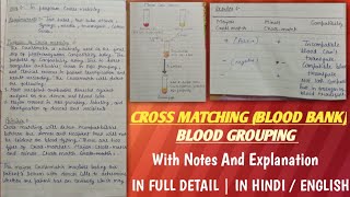 Cross matching blood  cross matching blood procedure  cross matching blood bank [upl. by Enrobialc]