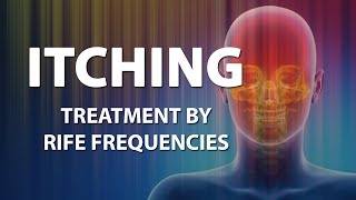 Itching Skin  RIFE Frequencies Treatment  Energy amp Quantum Medicine with Bioresonance [upl. by Erfert379]