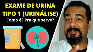 Exame de Urina Tipo 1  Urinálise  Sedimentoscopia  EAS  Sumário  IBAP Cursos [upl. by Sivahc]