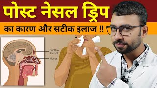 पोस्ट नेसल ड्रिप का इलाज़  Postnasal Drip Treatment  postnasal drip home remedy  Balgam ka karan [upl. by Araf]