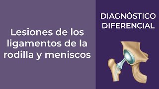 Diagnóstico Diferencial Lesiones de los ligamentos de la rodilla y meniscos [upl. by Fischer21]