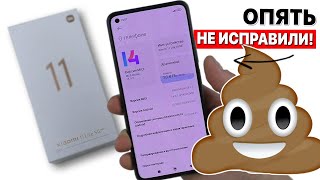 XIAOMI MI 11 LITE 5G NE  ПОЧТИ ИДЕАЛЬНЫЙ ТЕЛЕФОН НО [upl. by Palladin89]