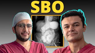 Ep 16 Mastering Bowel Obstruction Management Essential Tips for Surgeons [upl. by Aciretahs]