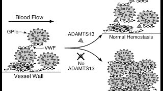 Thrombotic Thrombocytopenic Purpura TTP [upl. by Akinam]