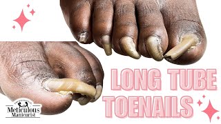 Trim Long Toenails Tutorial nails satisfying [upl. by Jentoft]