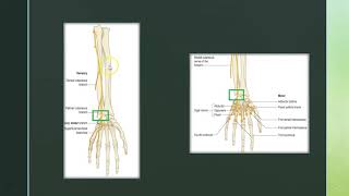 Chapitre 3 Atteinte du nerf ulnaire [upl. by Madra161]
