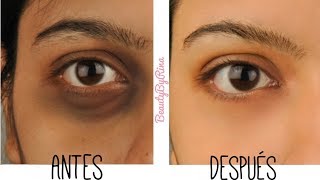 Como Eliminar Ojeras Y Bolsas En Minutos De Forma Natural [upl. by Aneala]