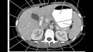 Abdominal quadrants regions and planes [upl. by Zinah]