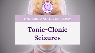 What are TonicClonic Seizures [upl. by Nnoved]