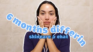 SKIN UPDATE AND LIFE CHAT 🏡🔑  3 months Post Doxycycline and 6 Months Differin Gel Update acne [upl. by Maillliw]