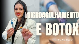 COMO FAZER MICROAGULHAMENTO COM BOTOX  Técnicas associadas [upl. by Rochette]