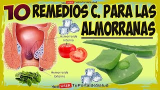 Eliminar Las Hemorroides 10 Remedios Caseros Para Curar Las Almorranas [upl. by Anaele]