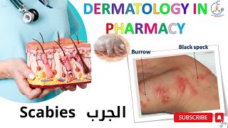 otc SCABIES DERMATOLOGY COURSE parasitic infestations Sarcoptes scabiei الجرب [upl. by Yecart341]