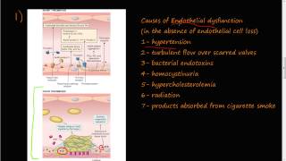 53  Thrombosis Virchows triad Endothelial Injury [upl. by Delwin]