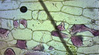 Red Onion Plasmolysis and Cytolysis [upl. by Materse151]