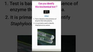 Quiz9  Biochemical test for identification of bacteria  shorts microbiology [upl. by Notsud]