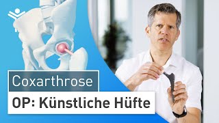 Hüftprothese Künstliches Hüftgelenk durch minimalinvasive Operation  HüftTEP [upl. by Rugg]