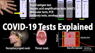 Heres how the tests for COVID19 actually work [upl. by Anett]