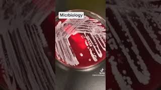 catalase test in microbiology [upl. by Enyar]