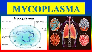 MYCOPLASMA  infection Diagnosis [upl. by Ahens819]