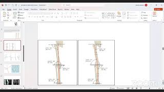 Principles of deformity correction [upl. by Vivie]