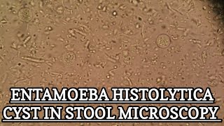 Entamoeba Histolytica Cyst under stool microscopy MLT WORLD [upl. by Bonnie696]