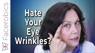 How To Get Rid Of Those Annoying Wrinkles Around Your Eyes [upl. by Yruy663]