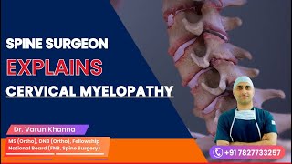 Spine surgeon explains Cervical Myelopathy क्या है सर्वाइकल माइलोपेथी neckpain cervical spine [upl. by Ttimme]