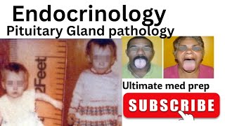 Pituitary Gland pathology  Hyperpituitarism Hypopituitarism medicalstudies usmle [upl. by Connie721]