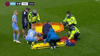 Esme Morgan broken leg injury [upl. by Puff441]