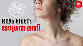 ഭയം വേണ്ട ജാഗ്രത മതി  Chickenpox  FactCheck [upl. by Rip981]