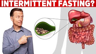 Does Intermittent Fasting Causes Gallstones – Dr Berg [upl. by Samp]