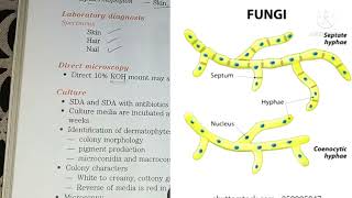 Superficial Mycoses  Fungal Infections [upl. by Vivian]