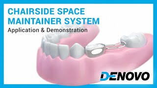 Pediatric Chairside Space Maintainer system — Application amp demonstration [upl. by Tlihcox]