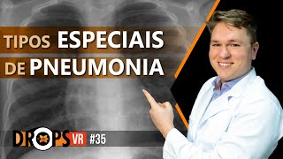 RECONHECENDO TIPOS ESPECIAIS DE PNEUMONIA [upl. by Longan]