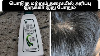 selsun shampoo for dandruff review in tamil  anti dandruff shampoo itchy scalp [upl. by Melodie]