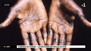 Mpox  La Réunion en veille active [upl. by Whorton]