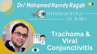 Conj 2 Trachoma amp Viral Conjunctivitis [upl. by Rein127]