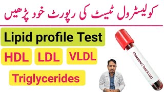 How To Read Cholesterol Test Report Urdu Hindi  Lipid Profile Test  HDL LDL amp Triglycerides Test [upl. by Pigeon]